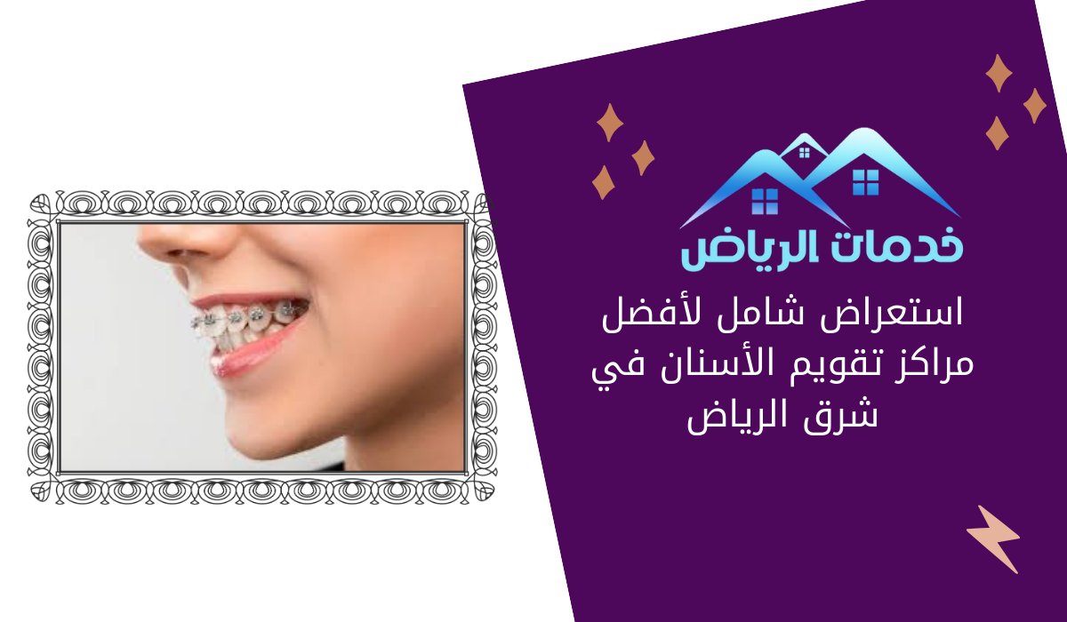 استعراض شامل لأفضل مراكز تقويم الأسنان في شرق الرياض