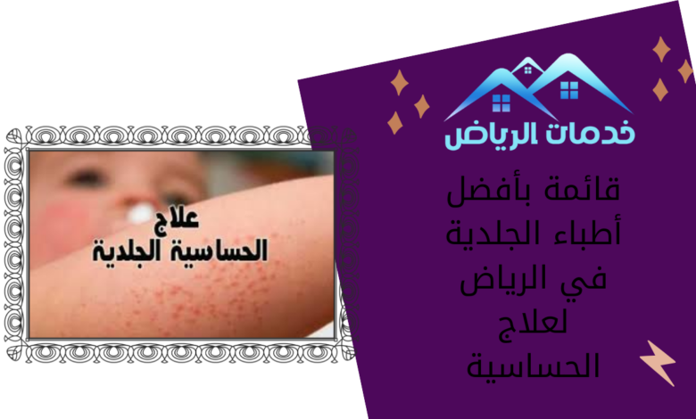 قائمة بأفضل أطباء الجلدية في الرياض لعلاج الحساسية