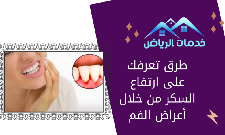 طرق تعرفك على ارتفاع السكر من خلال أعراض الفم