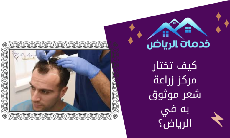 كيف تختار مركز زراعة شعر موثوق به في الرياض؟