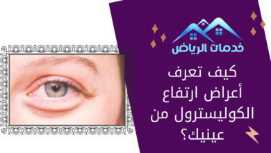 كيف تعرف أعراض ارتفاع الكوليسترول من عينيك؟