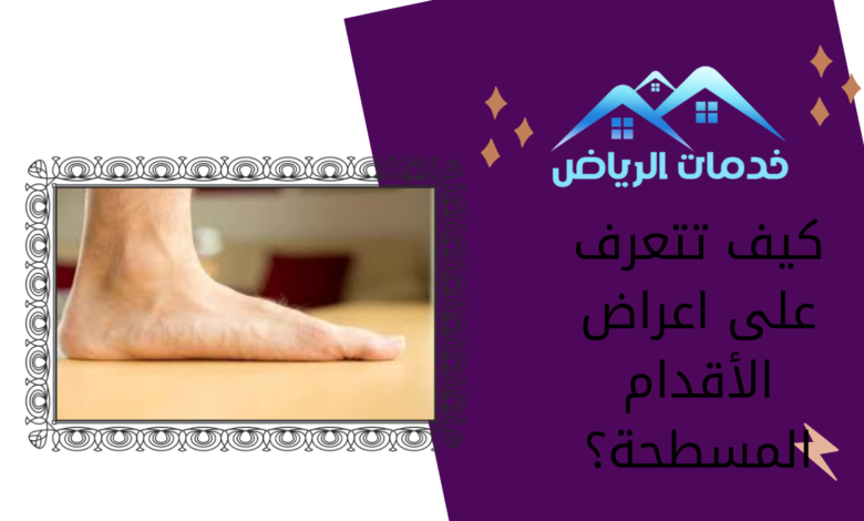 كيف تتعرف على اعراض الأقدام المسطحة؟