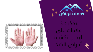 تحذير: 3 علامات على اليدين تكشف أمراض الكبد