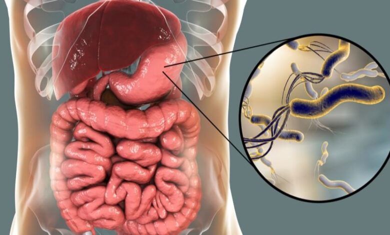 أعراض جرثومة المعدة