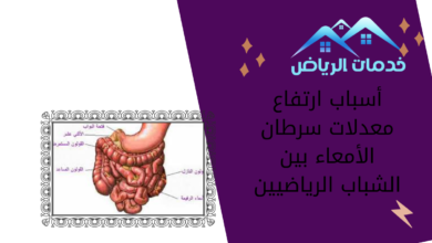 أسباب ارتفاع معدلات سرطان الأمعاء بين الشباب الرياضيين