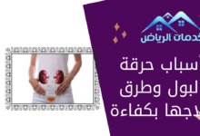 أسباب حرقة البول وطرق علاجها بكفاءة