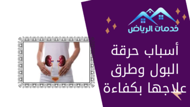 أسباب حرقة البول وطرق علاجها بكفاءة