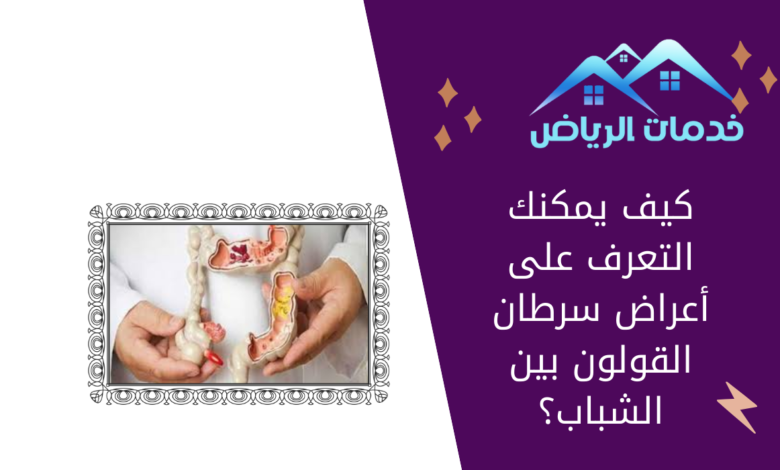 كيف يمكنك التعرف على أعراض سرطان القولون بين الشباب؟