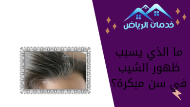 ما الذي يسبب ظهور الشيب في سن مبكرة؟