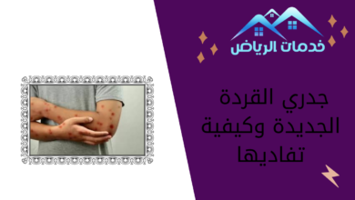 جدري القردة الجديدة وكيفية تفاديها