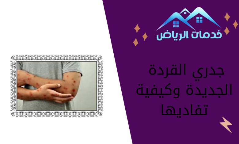 جدري القردة الجديدة وكيفية تفاديها