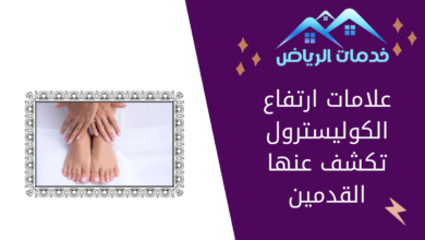 علامات ارتفاع الكوليسترول تكشف عنها القدمين