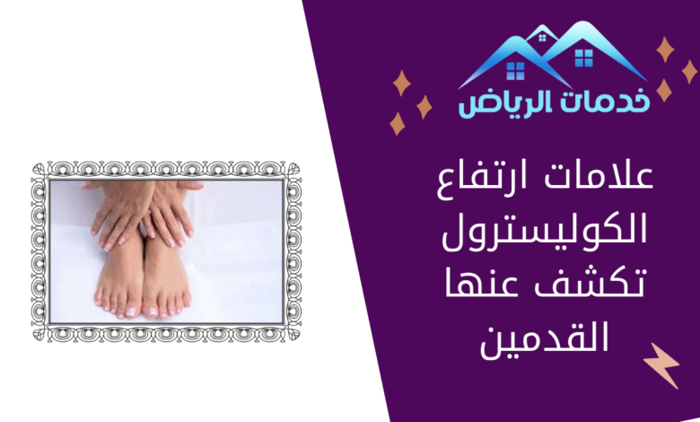 علامات ارتفاع الكوليسترول تكشف عنها القدمين