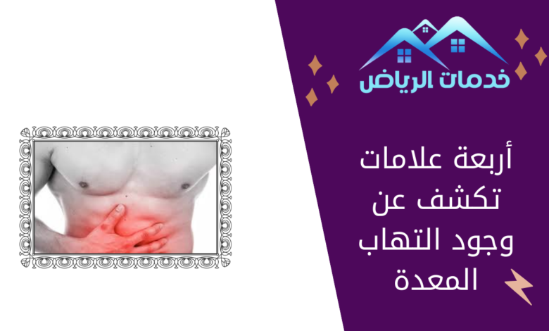 أربعة علامات تكشف عن وجود التهاب المعدة