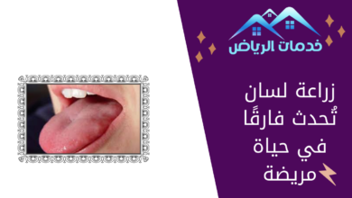 زراعة لسان تُحدث فارقًا في حياة مريضة