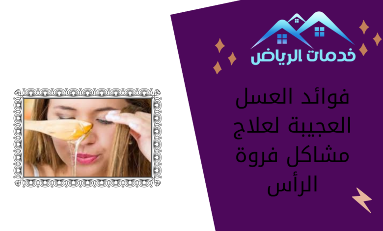 فوائد العسل العجيبة لعلاج مشاكل فروة الرأس