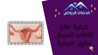 كيفية علاج التهاب المبيض بطرق طبيعية