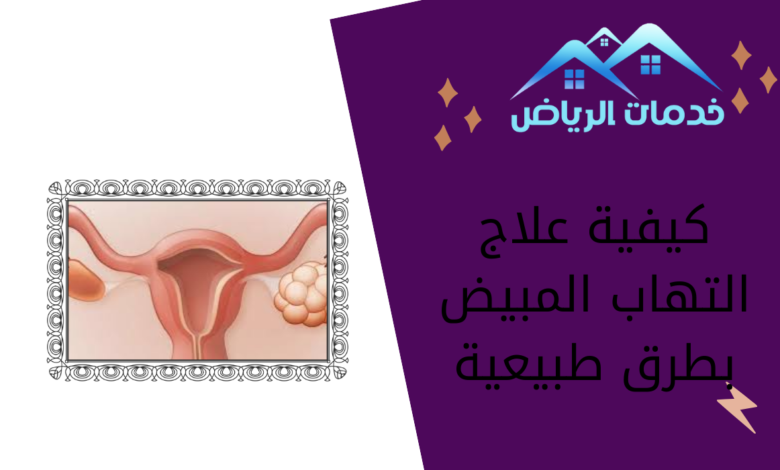 كيفية علاج التهاب المبيض بطرق طبيعية