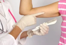 شريحة منع الحمل